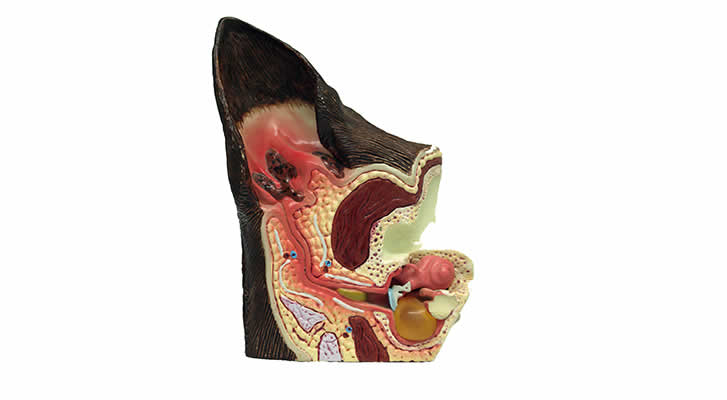 Ear Model showing chronic change and middle ear infection