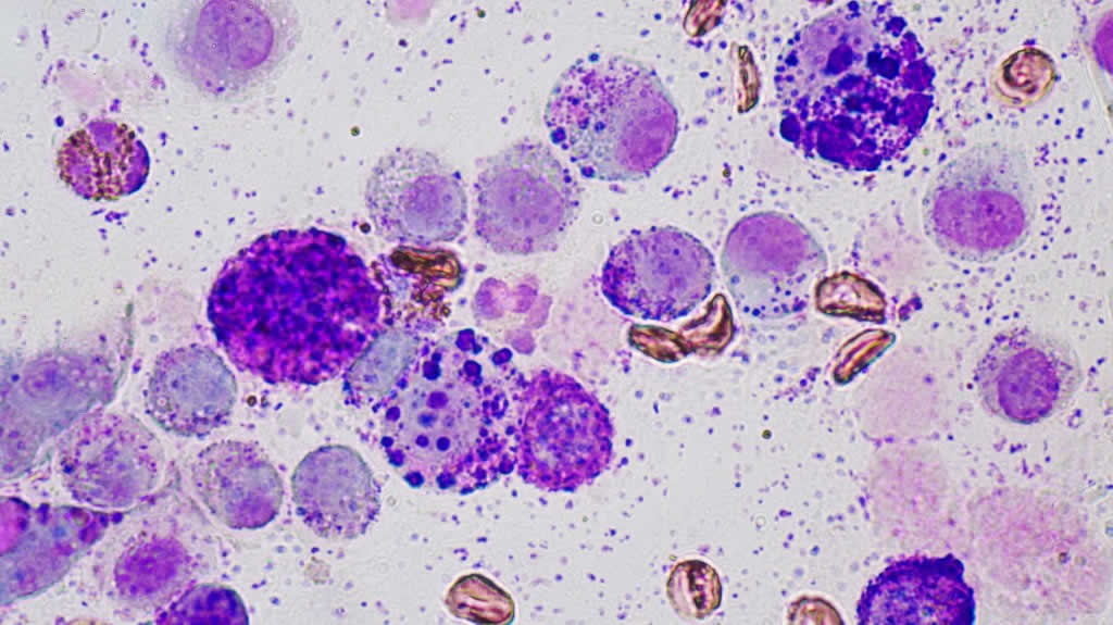 Cytology performed at the Dermvet Skin and Ear Clinic. From MCT on the right. Mast Cells of varying sizes, containing purple granules of varying sizes also