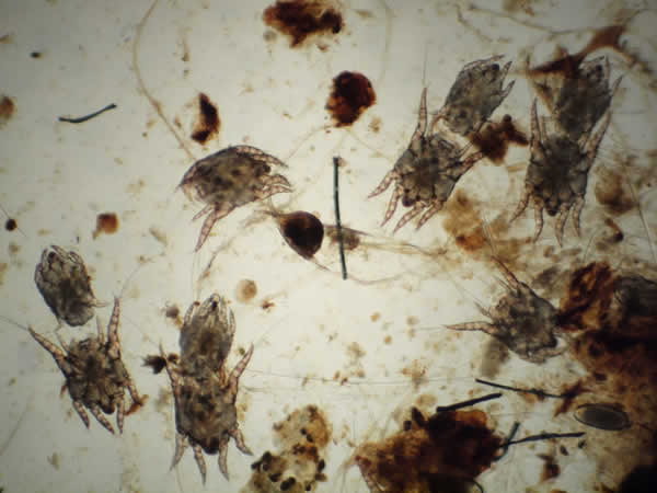 Otodectes Mites from Ear Debris Under Microscope