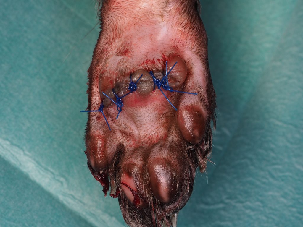 Plasma Cell Pododermatitis after laser excision of the bulk of the metatarsal pad